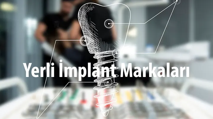 en uygun en iyi yerli implant markalari ve fiyatlari tavsiye