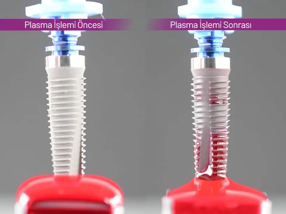 Plasma Active İmplant Uygulaması Plasma Active İmplant Fiyatları Ankara. Plazma İmplant Nedir?